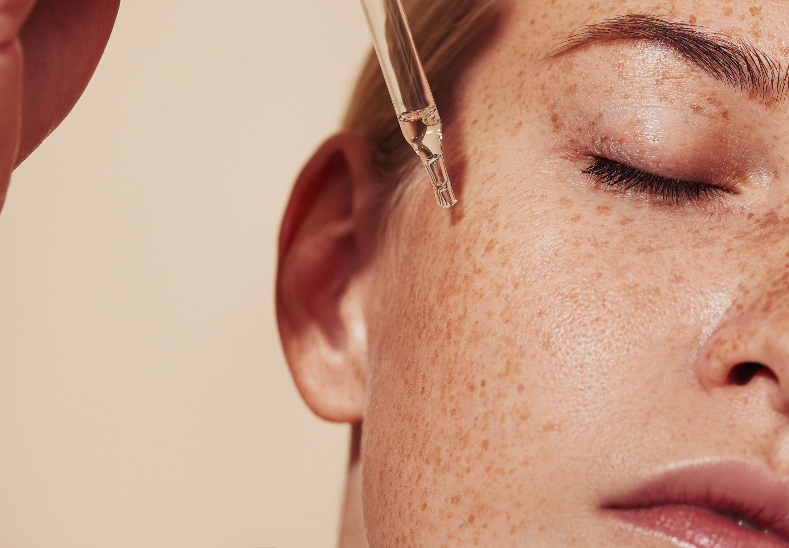 Close Up Highly Detailed Shot Of Female Skin With Freckles And Pipette With Serum. Cropped Shot Of Young Woman With Smooth Perfect Skin Applying Liquid Serum On Face.